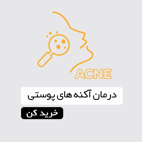 درمان آکنه پوست