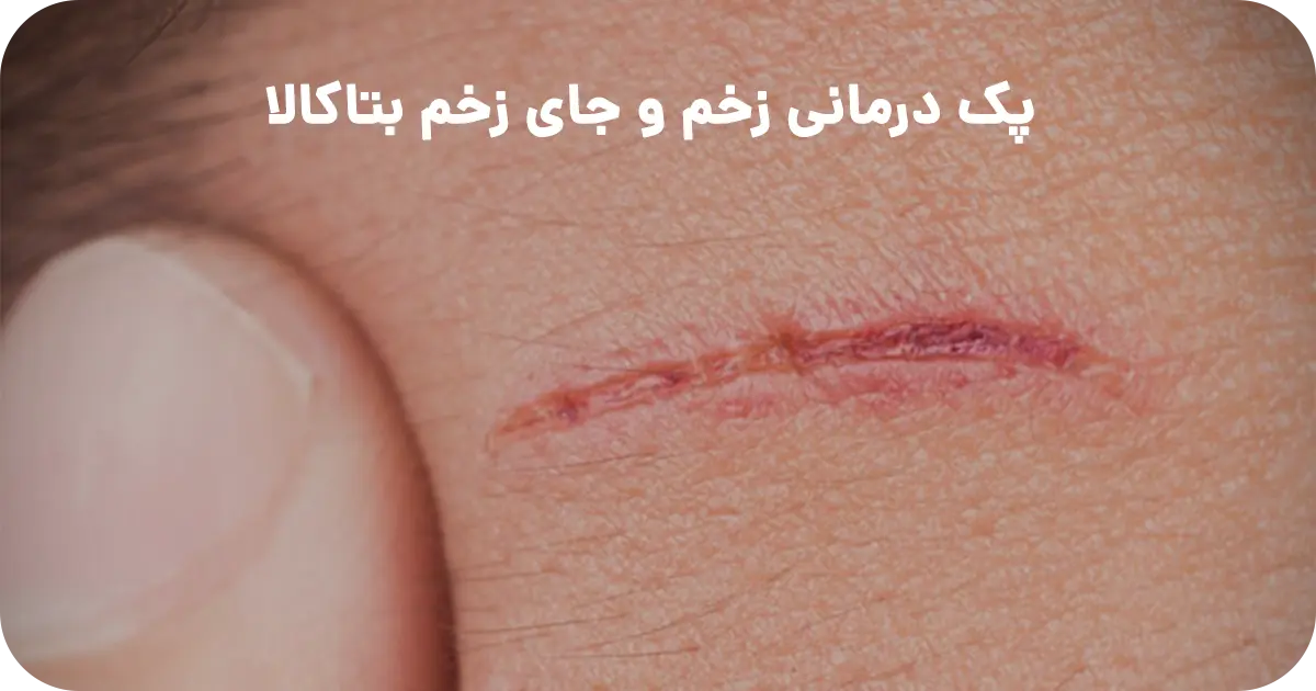 پک درمانی زخم و جای زخم بتاکالا