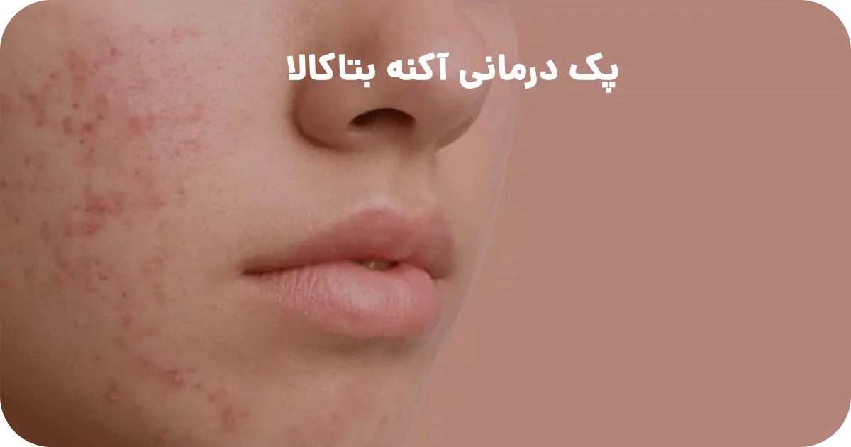 پک درمانی آکنه بتاکالا