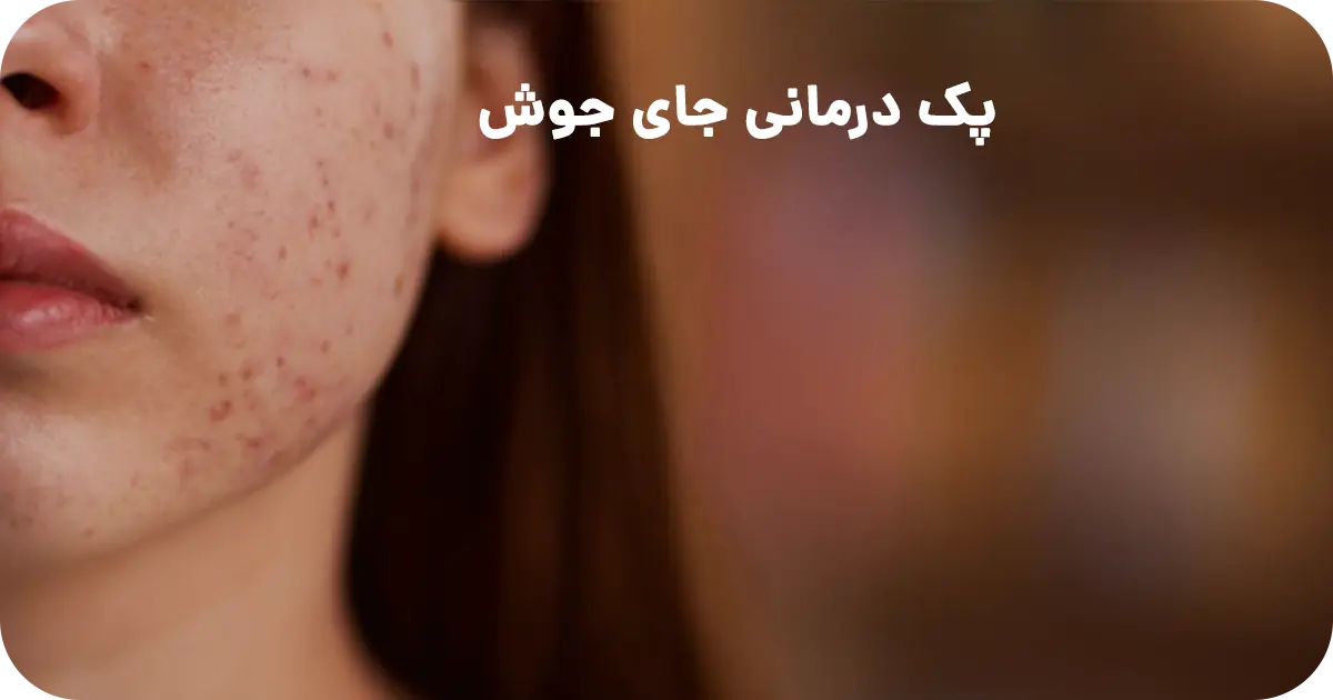 پک درمانی جای جوش بتاکالا