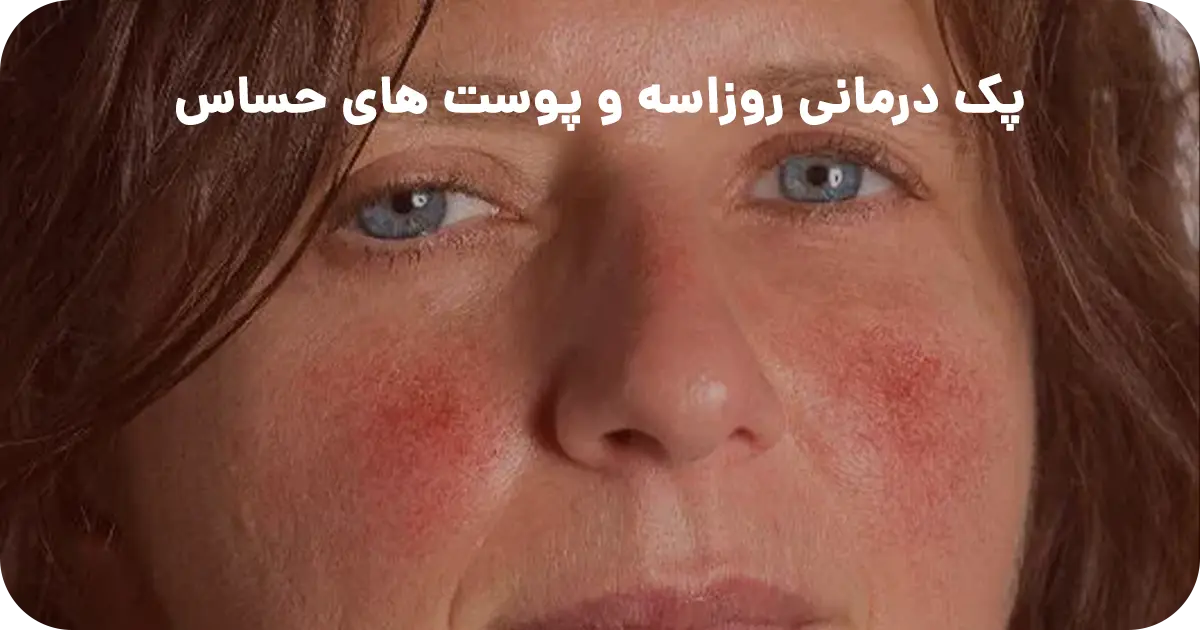 پک درمانی روزاسه و پوست های حساس بتاکالا