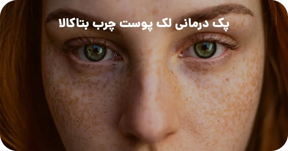 پک درمانی لک (پوست چرب)