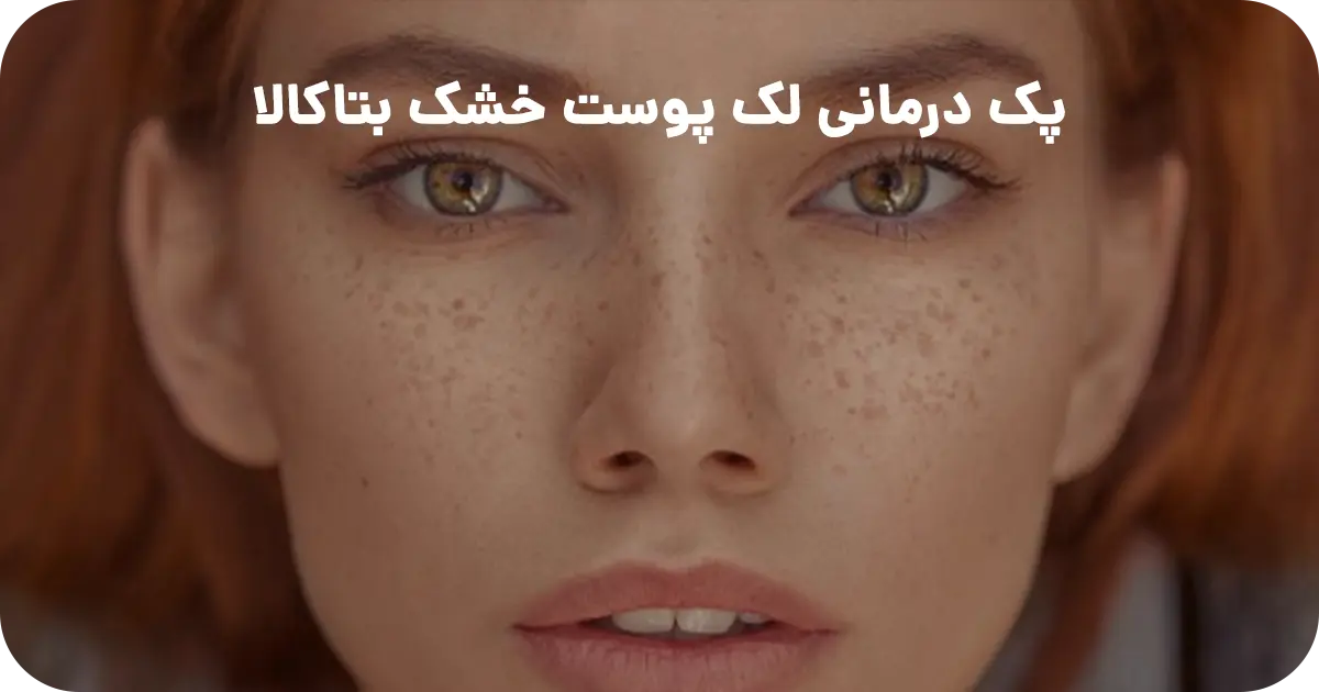 پک درمانی لک (پوست خشک) بتاکالا